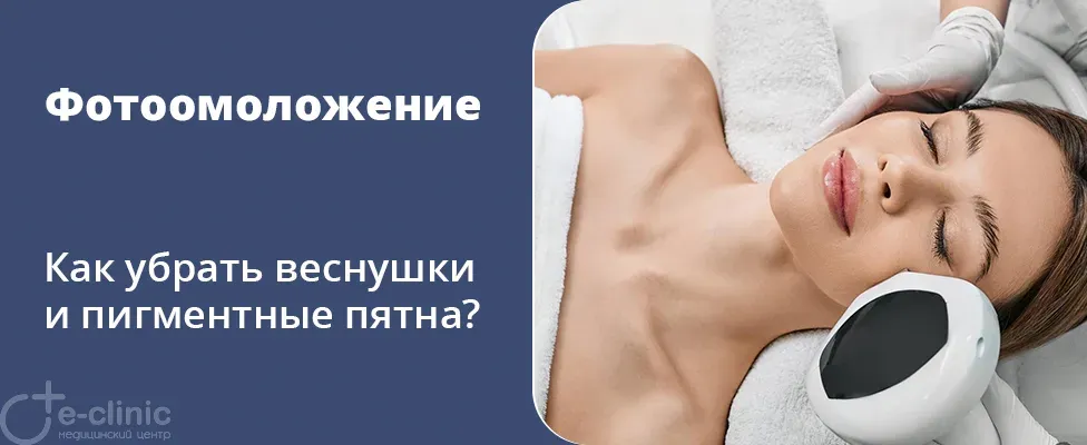Фотоомоложение (IPL) при пигментации кожи: как убрать веснушки и пигментные пятна