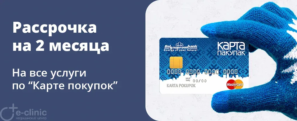 Рассрочка на 2 месяца по "Карте покупок"