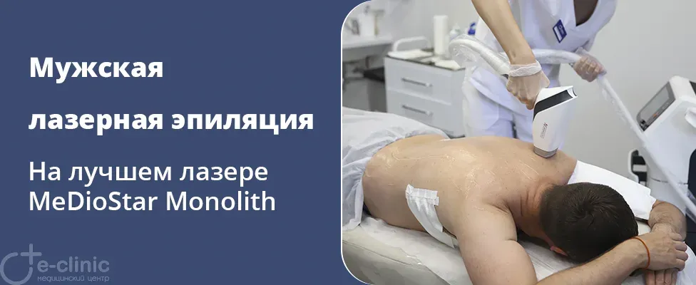 Мужская лазерная эпиляция