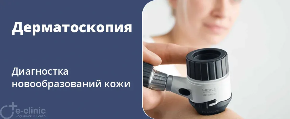 В нашем центре доступна дерматоскопия — точный метод диагностики новообразований кожи