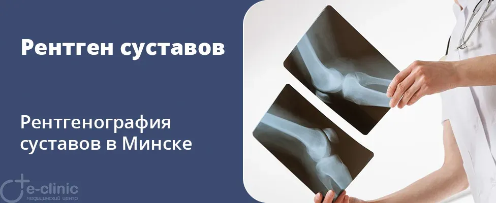 Рентген суставов