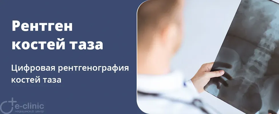 Рентген костей таза