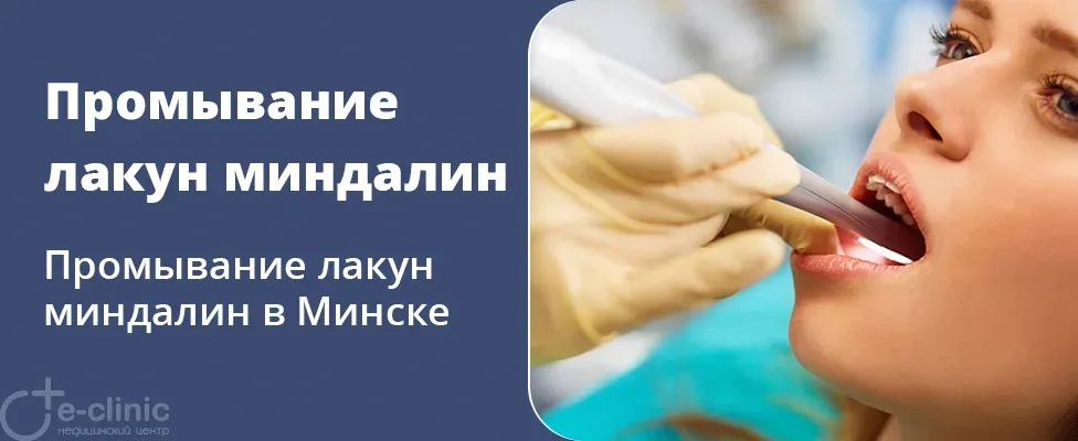 Промывание лакун миндалин