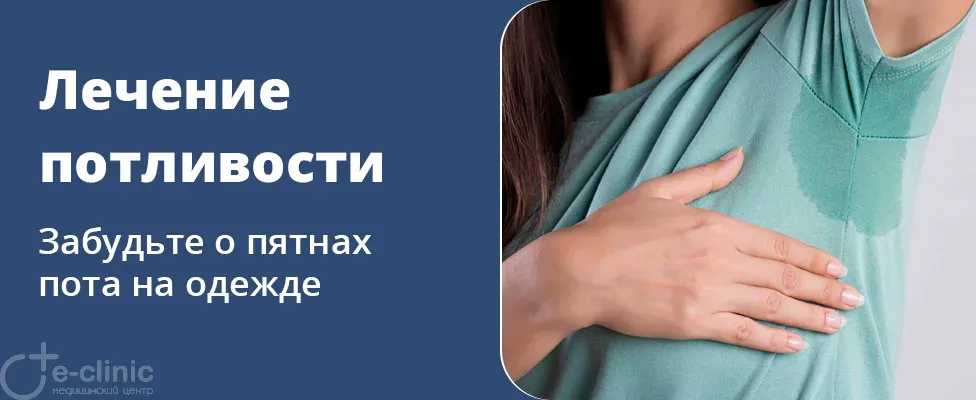 Решение проблемы повышенной потливости