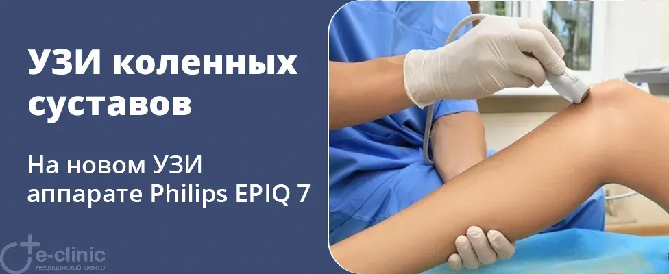 УЗИ коленных суставов