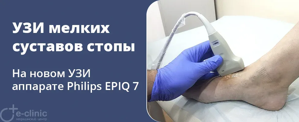 УЗИ мелких суставов стопы