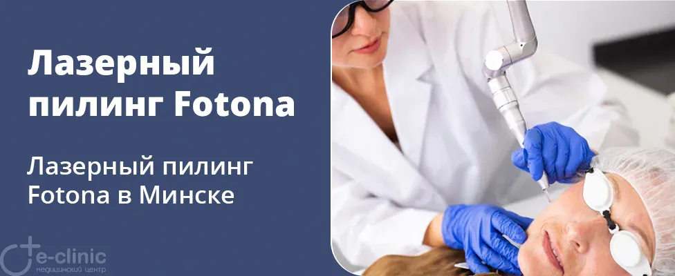 Лазерный пилинг Fotona