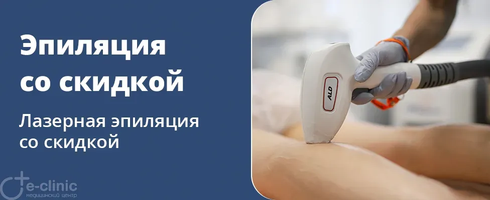 Лазерная эпиляция со скидкой 20%